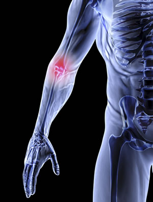 Elbow Pain Treatment NYC