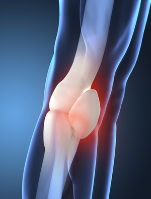 Post Surgery Knee Pain Treatment NYC
