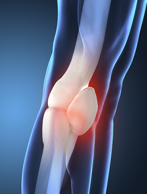 Post Surgery Knee Pain Treatment NYC
