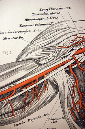 Thoracic Outlet Syndrome