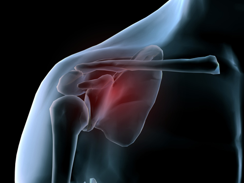 Shoulder pain treatment